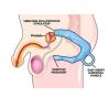 Men's Pleasure Wand Prostate Massager Red Sex Toy Product Image 4